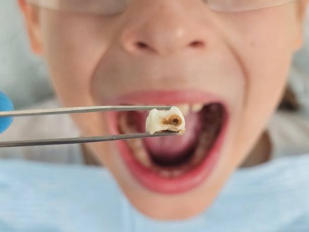 Best After-Hours Emergency Dentist in Murraysville, NC